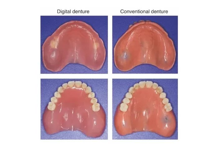 Digital versus Conventional Dentures: A Prospective, Randomized Cross-Over Study on Clinical Efficiency and Patient Satisfaction – Lana Zupančić Čepić